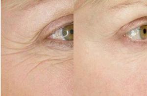 After 8 Weeks Eye Cream