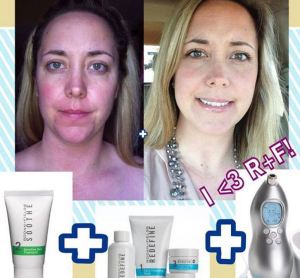 Before and After Redefine Regimen